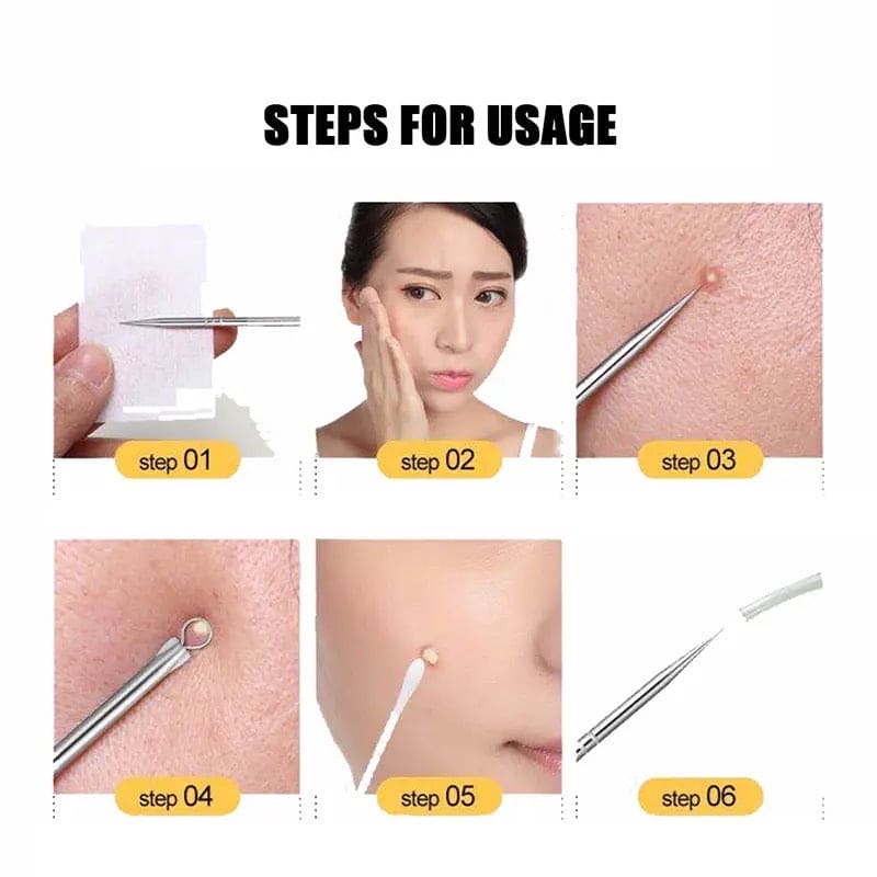 Set Of 4 Pimple Popper Needle, 4-In-1 Multifunctional Acne Needles, Blackhead Remover Tools, Spoon Face Skin Care Tools, Steel Blackhead Removal Kit, Women Beauty Acne Treatment Pore Cleanser Needle Hook, Comedone Extractor Remover Set for All Skin Types Set Of 4 Pimple Popper Needle, 4-In-1 Multifunctional Acne Needles, Blackhead Remover Tools, Spoon Face Skin Care Tools, Steel Blackhead Removal Kit, Women Beauty Acne Treatment Pore Cleanser Needle Hook, Comedone Extractor Remover Set for All Skin Types